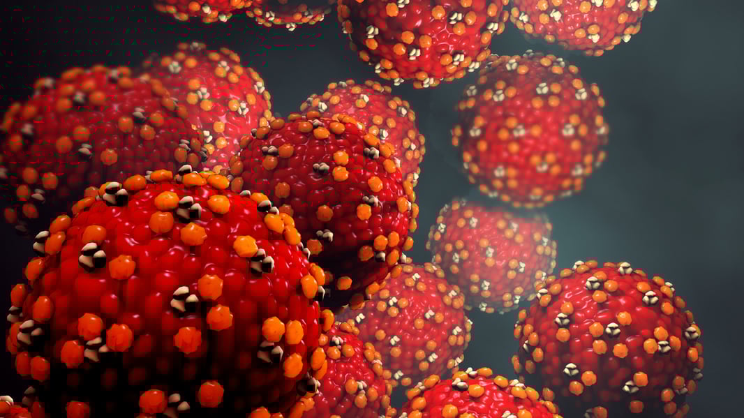 Measles-Stock